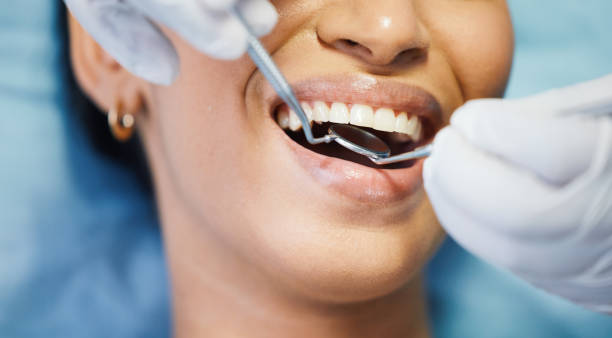 Best Emergency Tooth Extraction in Moreland, ID